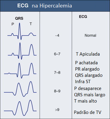 ecg